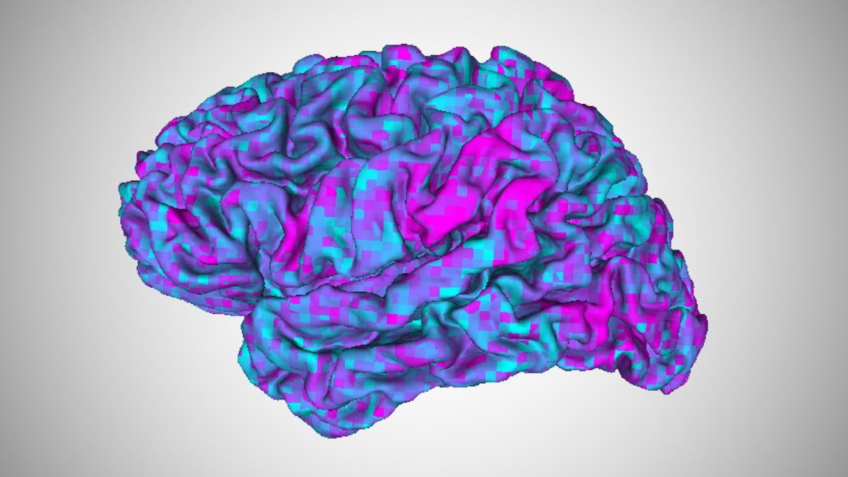 Brain activity like this, measured in an fMRI machine, can be used to train a brain decoder to decipher what a person is thinking about. In this latest study, UT Austin researchers have developed a method to adapt their brain decoder to new users far faster than the original training, even when the user has difficulty comprehending language.