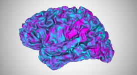 Brain activity like this, measured in an fMRI machine, can be used to train a brain decoder to decipher what a person is thinking about. In this latest study, UT Austin researchers have developed a method to adapt their brain decoder to new users far faster than the original training, even when the user has difficulty comprehending language. Credit: Jerry Tang/University of Texas at Austin. Brain activity like this, measured in an fMRI machine, can be used to train a brain decoder to decipher what a person is thinking about. In this latest study, UT Austin researchers have developed a method to adapt their brain decoder to new users far faster than the original training, even when the user has difficulty comprehending language.