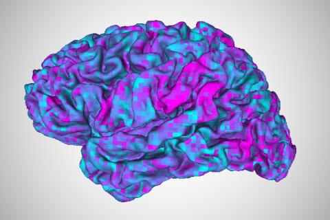 Brain activity like this, measured in an fMRI machine, can be used to train a brain decoder to decipher what a person is thinking about. In this latest study, UT Austin researchers have developed a method to adapt their brain decoder to new users far faster than the original training, even when the user has difficulty comprehending language.